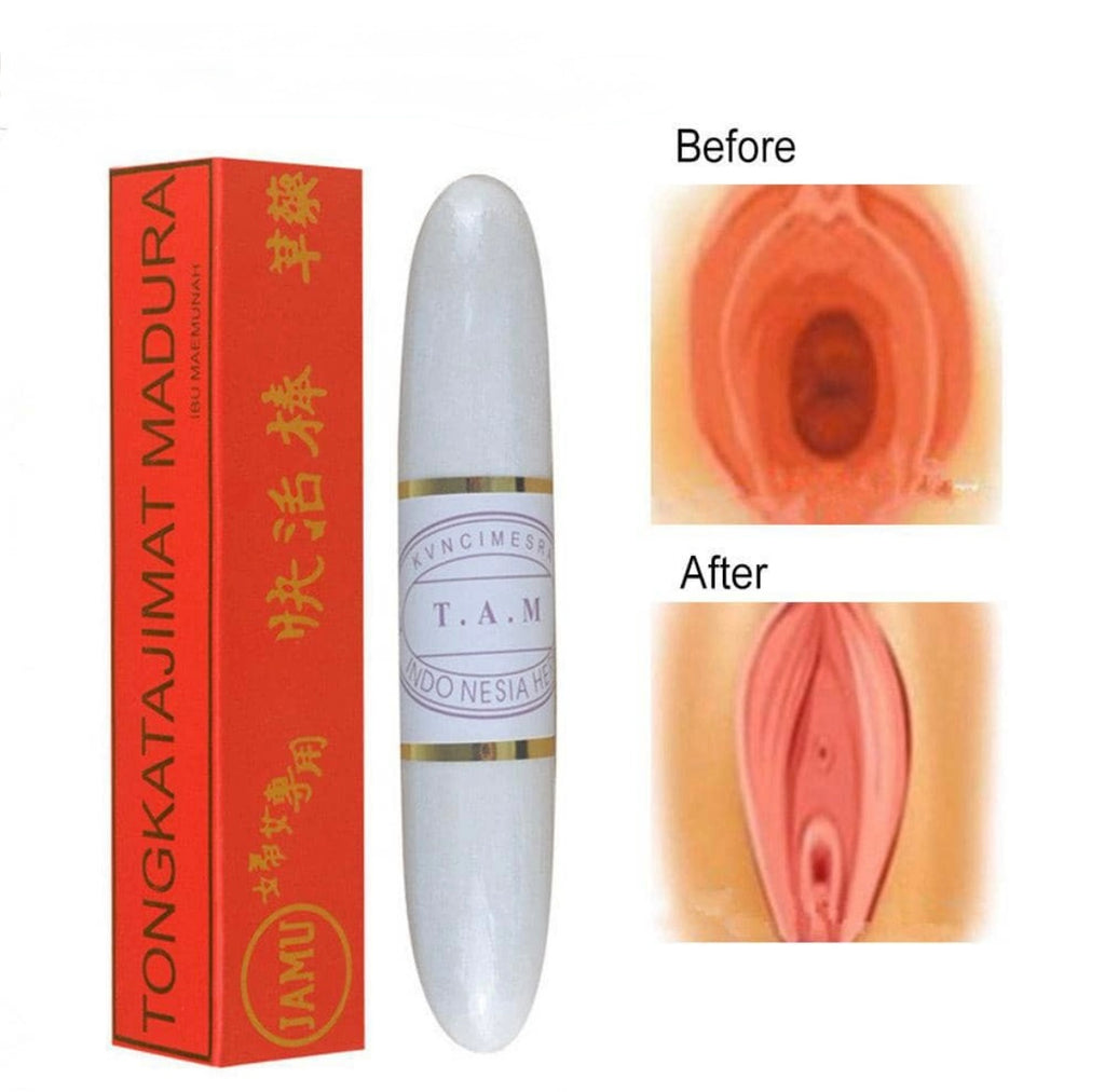 Craie vaginale