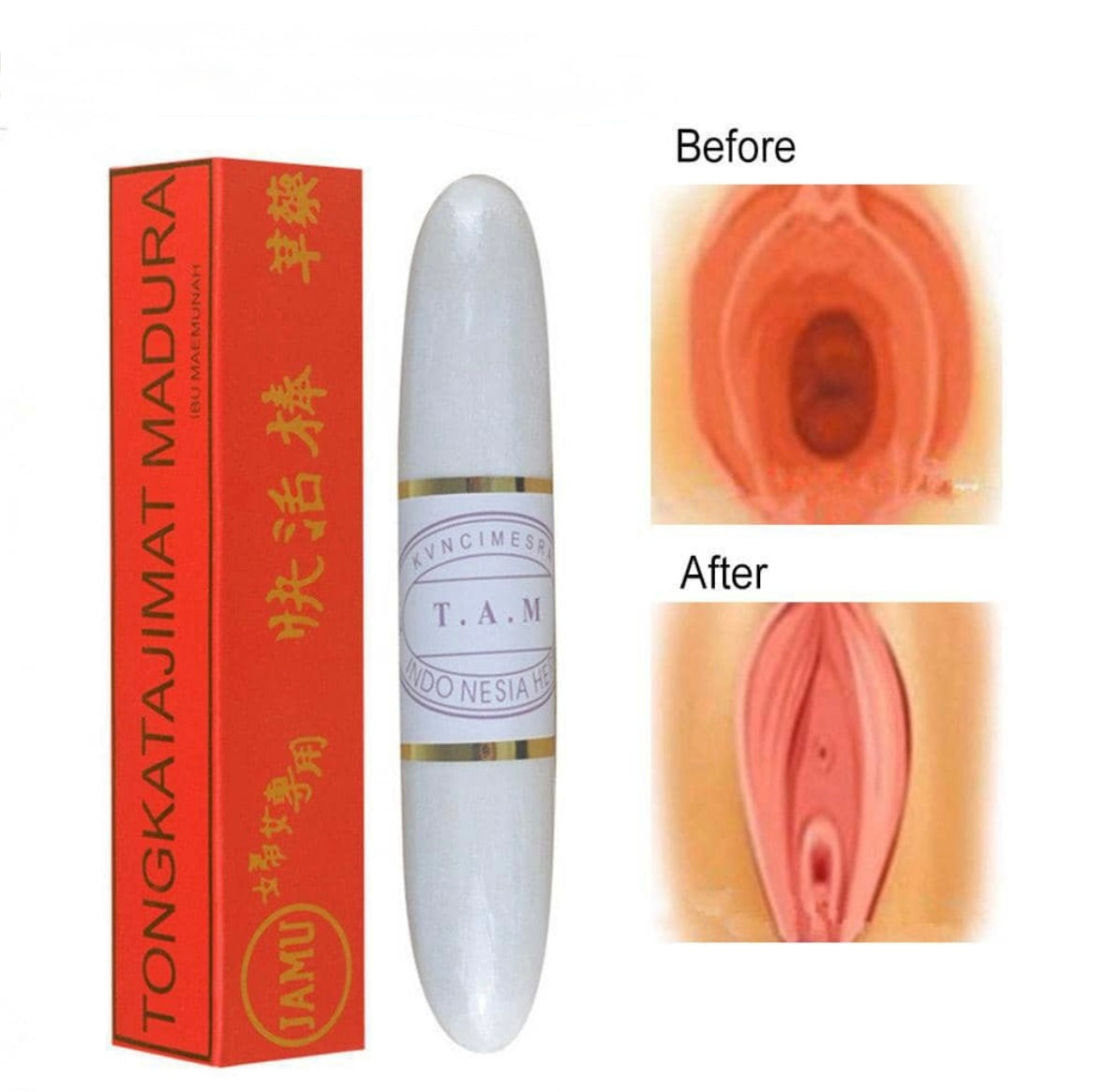 Craie vaginale